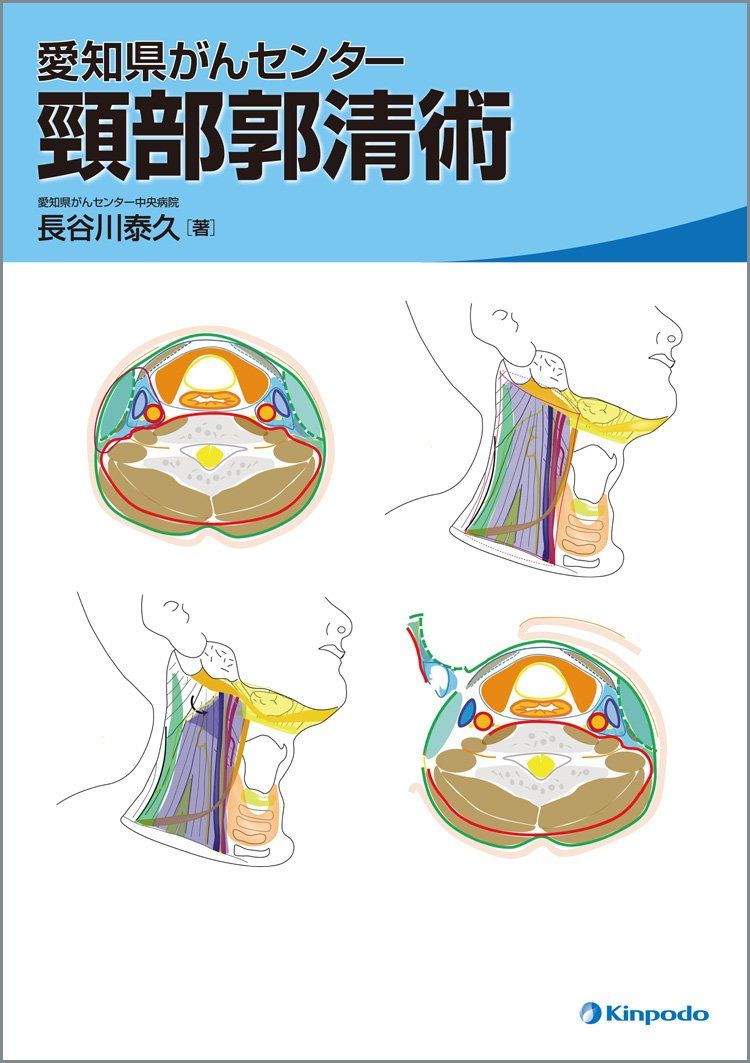 愛知県がんセンター 頸部郭清術