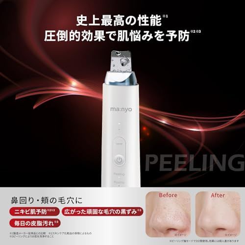 【新品】ma:nyo マニョ プラズマショットブースター 美顔器 毛穴洗浄 イオン導入 超音波 ピーリング 超音波振動 イオンケア 毛穴汚れ 黒ずみ 防水 浸透 5d16650d 【新品】ma:nyo マニョ プラズマショットブースター 美顔器 毛穴洗浄 イオン導入 超音波 ピーリング 超音波振動 イオンケア 毛穴汚れ 黒ずみ 防水 浸透 5d16650d