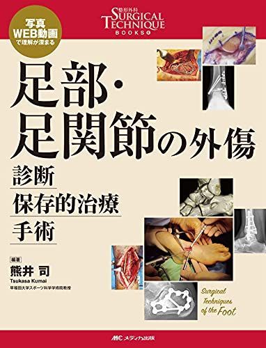 足部・足関節の外傷 診断・保存的治療・手術: 写真・WEB動画で理解が深まる (整形外科SURGICAL TECHNIQUE BOOKS 8)