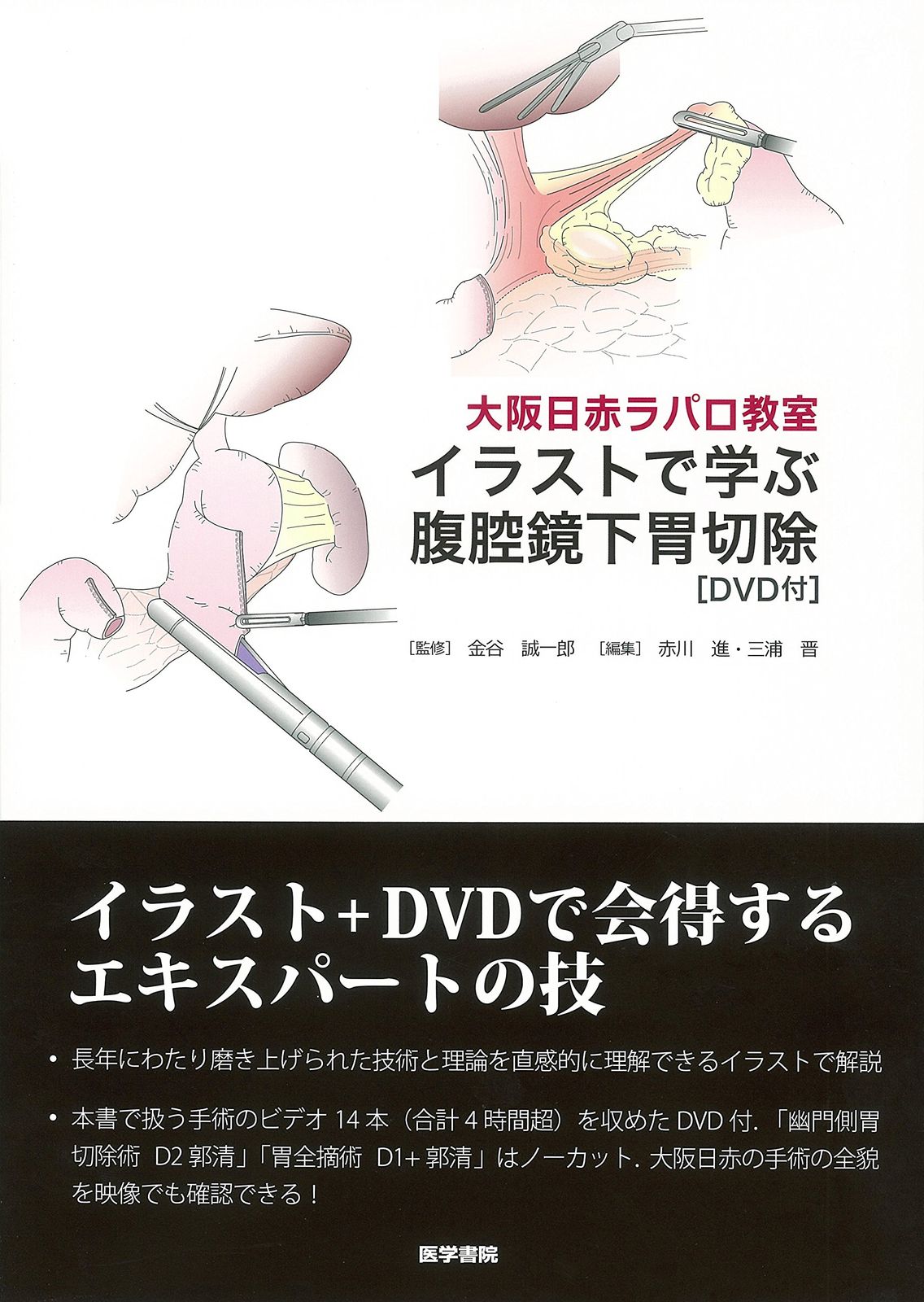 大阪日赤ラパロ教室 イラストで学ぶ腹腔鏡下胃切除[DVD付]