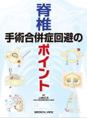 脊椎手術 合併症回避のポイント