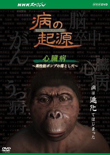 NHKスペシャル 病の起源 心臓病 ~高性能ポンプの落とし穴~ [DVD]