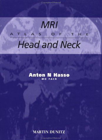 [2B]MRI Atlas of the Head and Neck