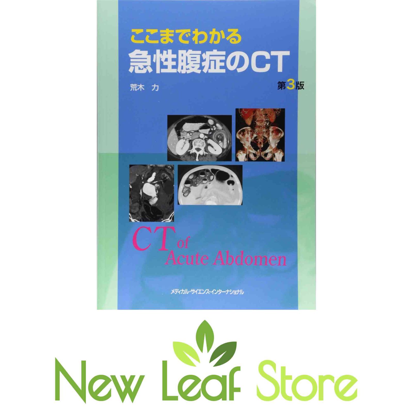 ここまでわかる急性腹症のCT 第3版 荒木 力