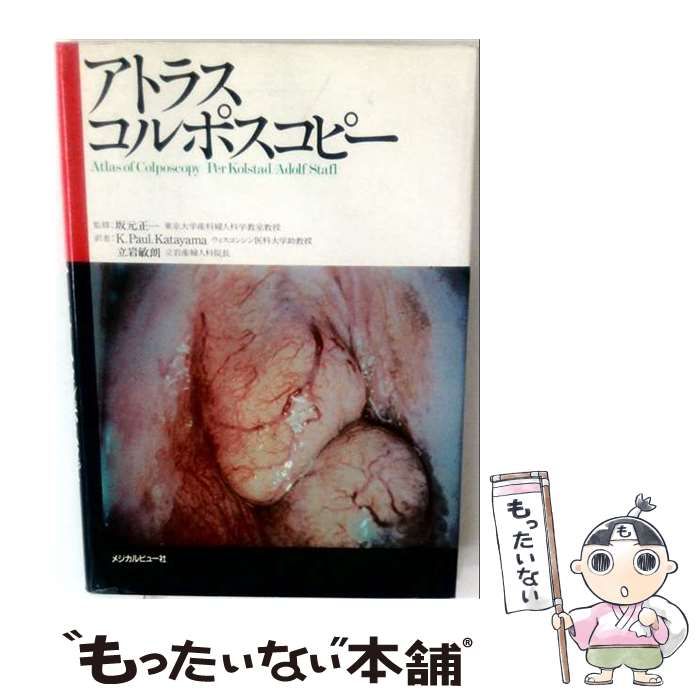 【中古】 アトラスコルポスコピー / / メジカルビュー社