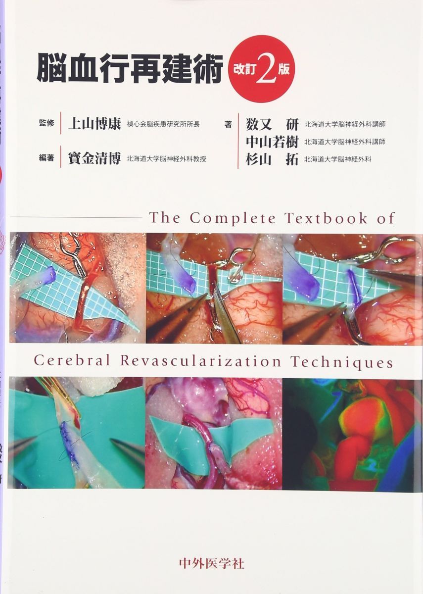 脳血行再建術 改訂2版