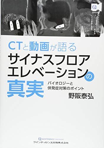CTと動画が語る サイナスフロアエレベーションの真実／野阪 泰弘