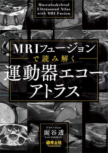 MRIフュージョンで読み解く　運動器エコーアトラスas 41b0bd6a