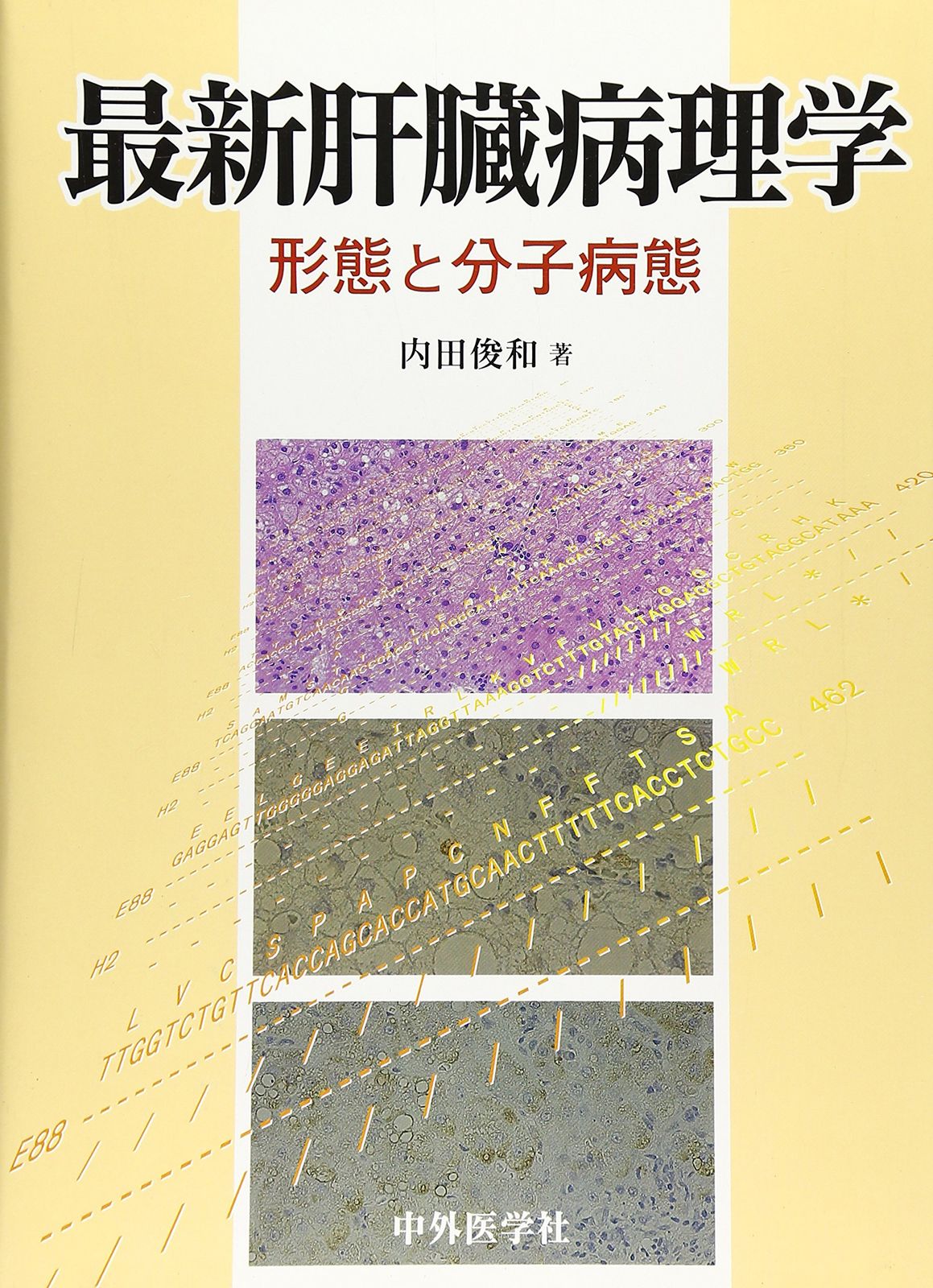 [2A]最新肝臓病理学