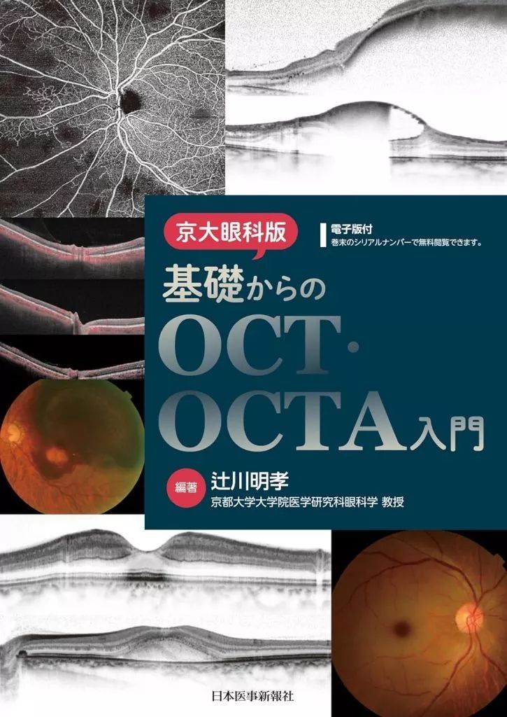 【中古】単行本(実用) ≪医学≫ 京大眼科版 基礎からのOCT・OCTA入門 / 辻川明孝