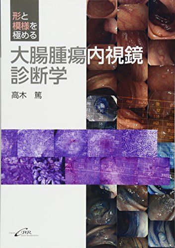 形と模様を極める大腸腫瘍内視鏡診断学