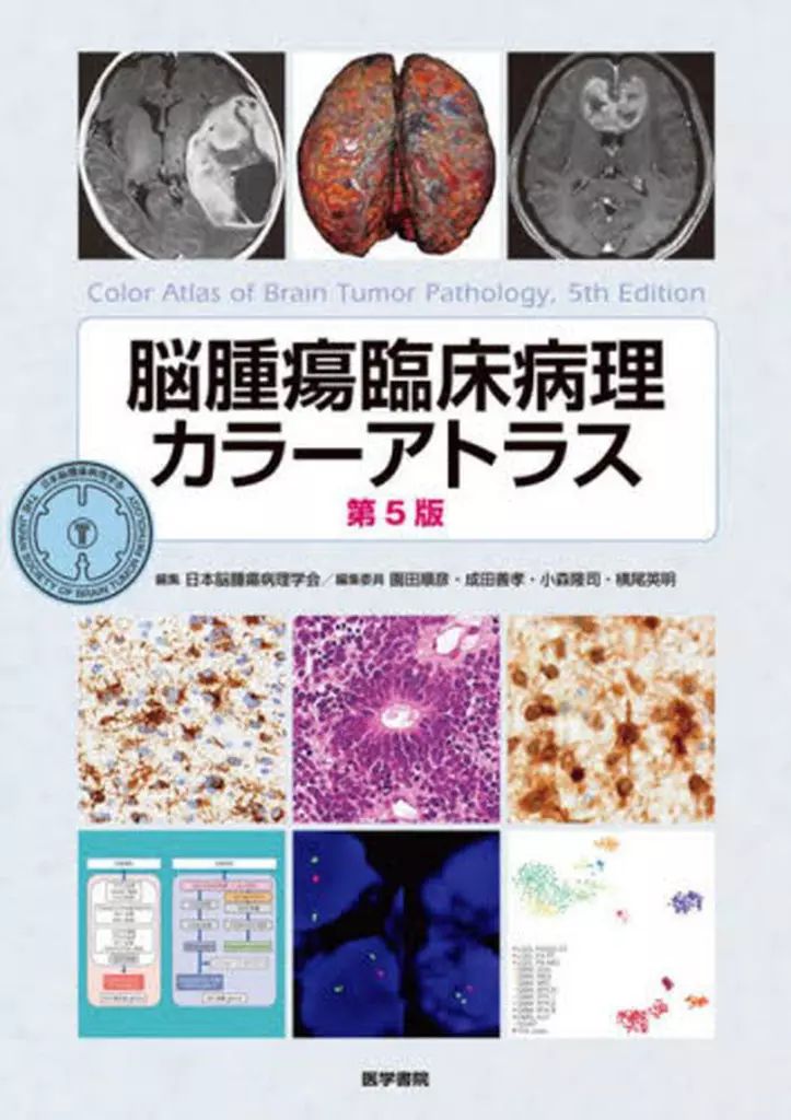 【中古】単行本(実用) ≪医学≫ 脳腫瘍臨床病理カラーアトラス 第5版 / 日本脳腫瘍病理学会 / 園田順彦