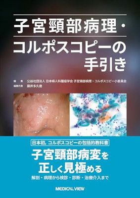 子宮頸部病理・コルポスコピーの手引き