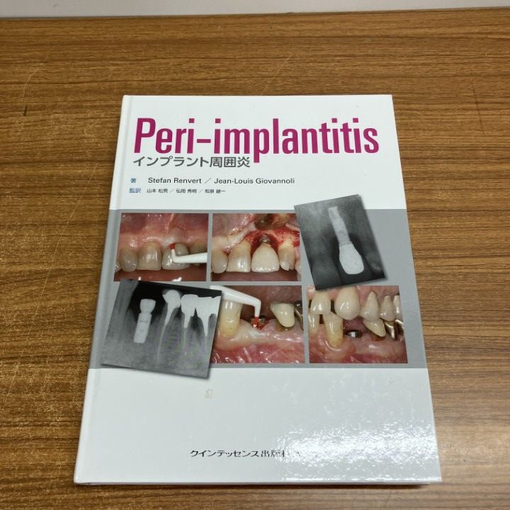 ▲01)【1点限り!】インプラント周囲炎/Peri-implantitis/ステファン・レンバート/クインテッセンス出版/2013年/歯科学/A