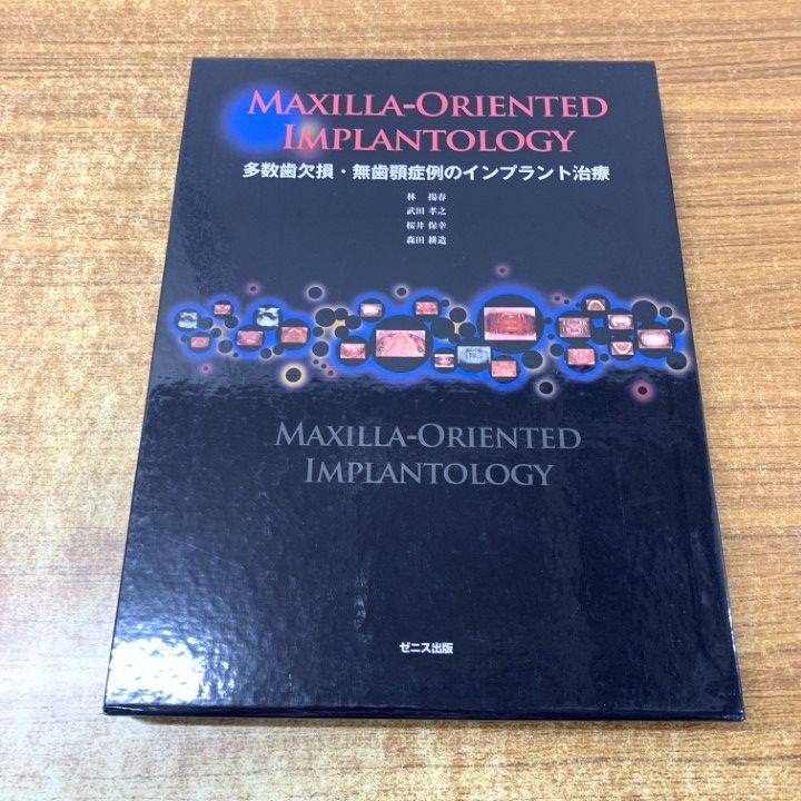 多数歯欠損・無歯顎症例のインプラント治療 本 多数歯欠損・無歯顎症例のインプラント治療