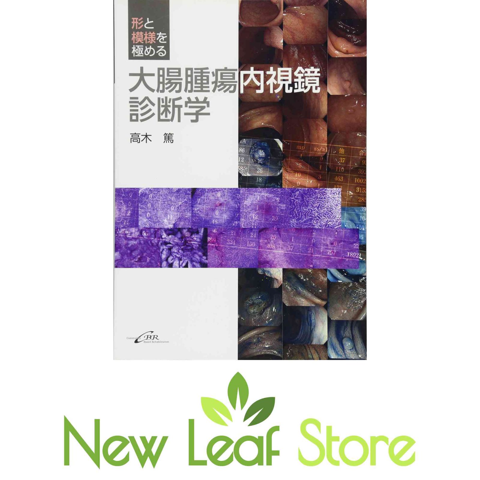 形と模様を極める大腸腫瘍内視鏡診断学 [Tankobon Hardcover] 高木 篤