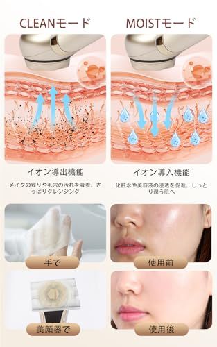 美顔器 1台多役 EMS イオン導入 RF美顔器 超音波美顔器