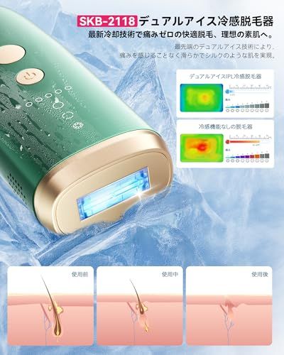 YUNDOO 脱毛器 レディース メンズ サロン級冷感無痛 【2025革新的連射冷却アイス 痛感ゼロ IPL光脱毛】VIO対応 美肌モード レディース メンズ 光脱毛器 99万回照射 5段階調節 高出力 デュアルアイス冷却脱毛 顔 髭 脇 腕 4f4349cc YUNDOO 脱毛器 レディース メンズ サロン級冷感無痛 【2025革新的連射冷却アイス 痛感ゼロ IPL光脱毛】VIO対応 美肌モード レディース メンズ 光脱毛器 99万回照射 5段階調節 高出力 デュアルアイス冷却脱毛 顔 髭 脇 腕 4f4349cc