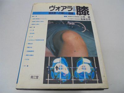 ヴォアラ膝: 膝疾患への新しい展開 40,065円