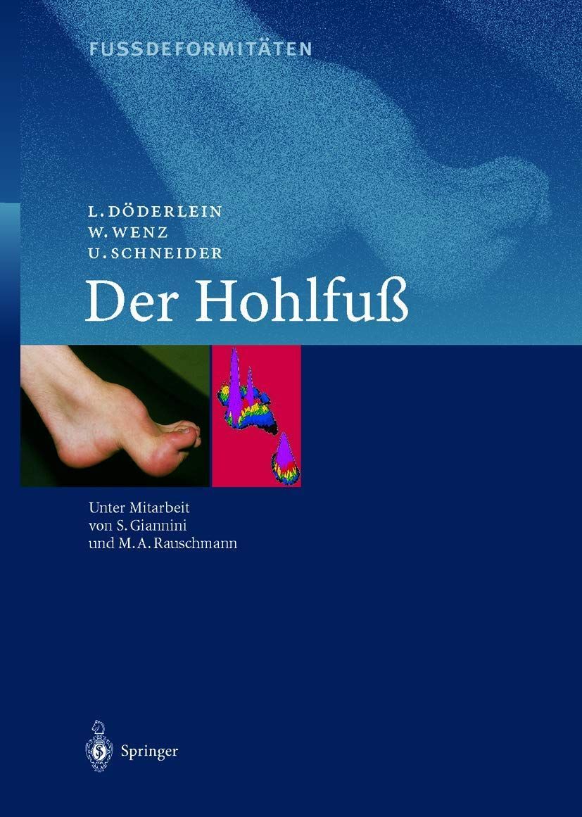 Fussdeformitaeten: Der Hohlfuss