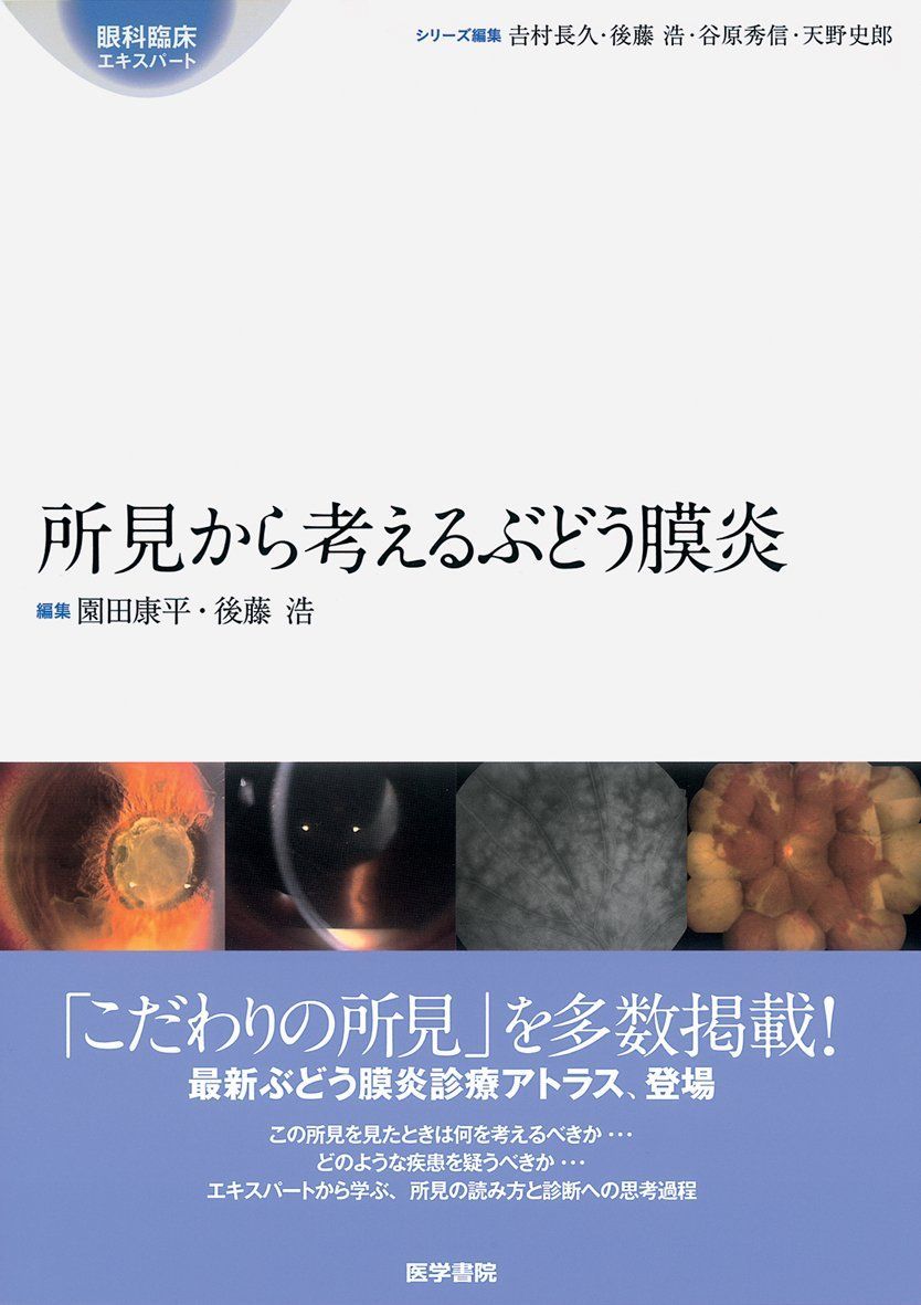 所見から考えるぶどう膜炎 (眼科臨床エキスパート) 29,668円