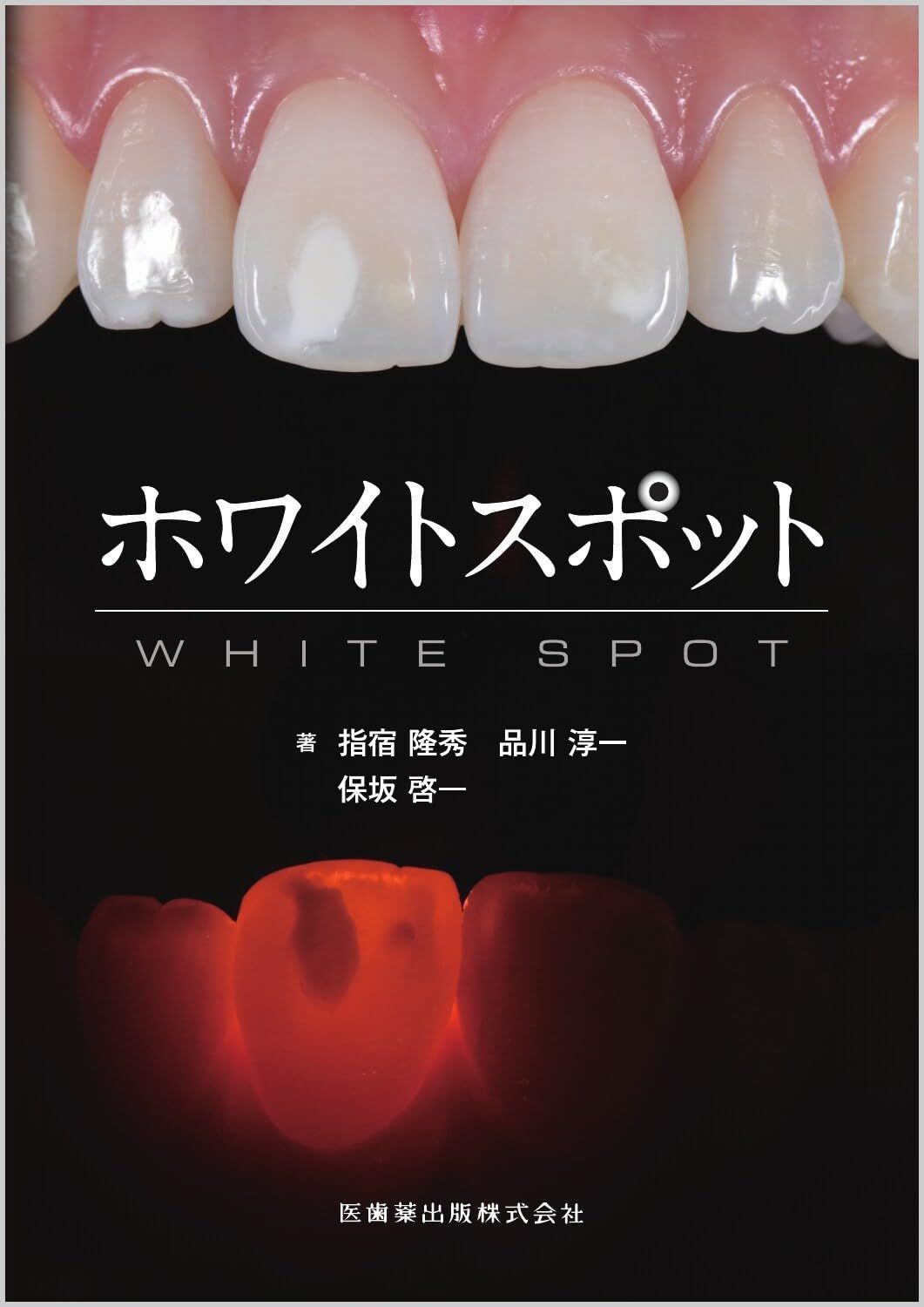 ホワイトスポット