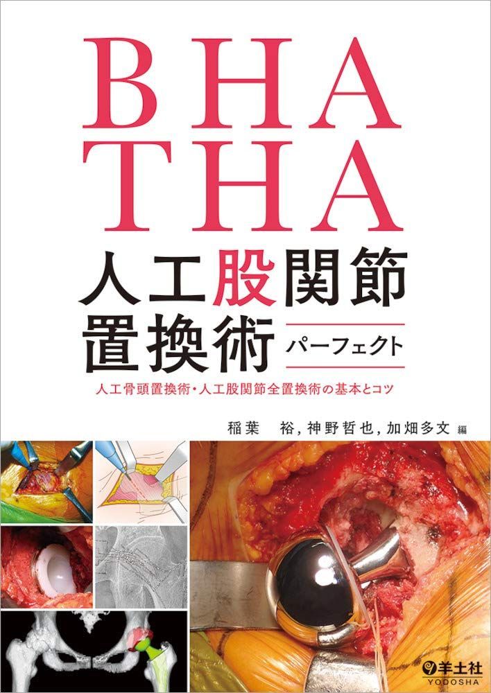BHA・THA 人工股関節置換術パーフェクト?人工骨頭置換術・人工股関節全置換術の基本とコツ