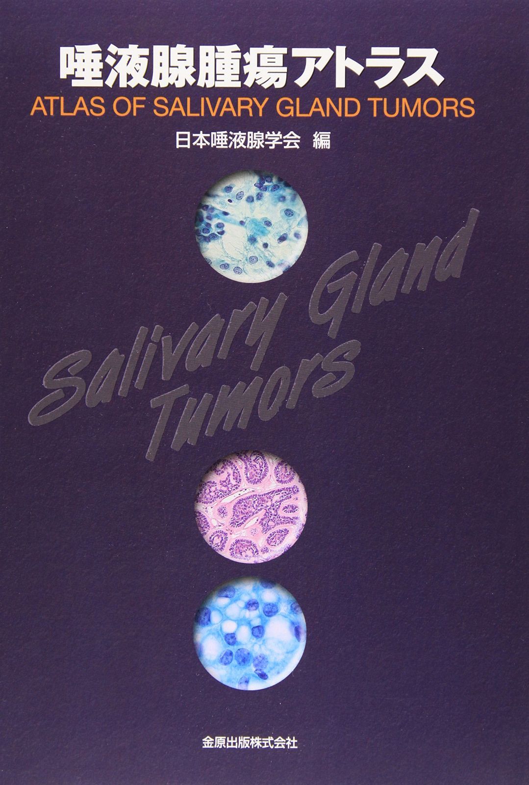 唾液腺腫瘍アトラス