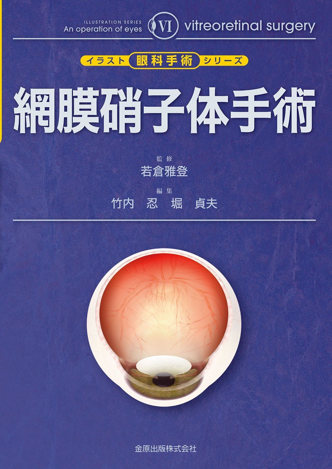網膜硝子体手術 (イラスト眼科手術シリーズ 6) 27,010円