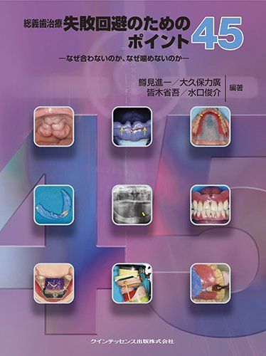 総義歯治療 失敗回避のためのポイント45