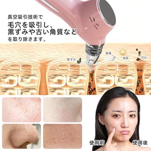 NIPLUX マルチスキンクリーナー 毛穴吸引器 美容 毛穴ケア