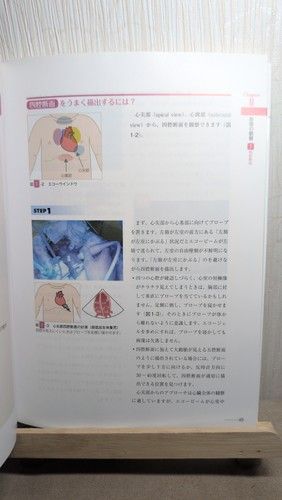 新生児の心エコー入門: 超音波検査にもとづくNICU循環管理のススメ