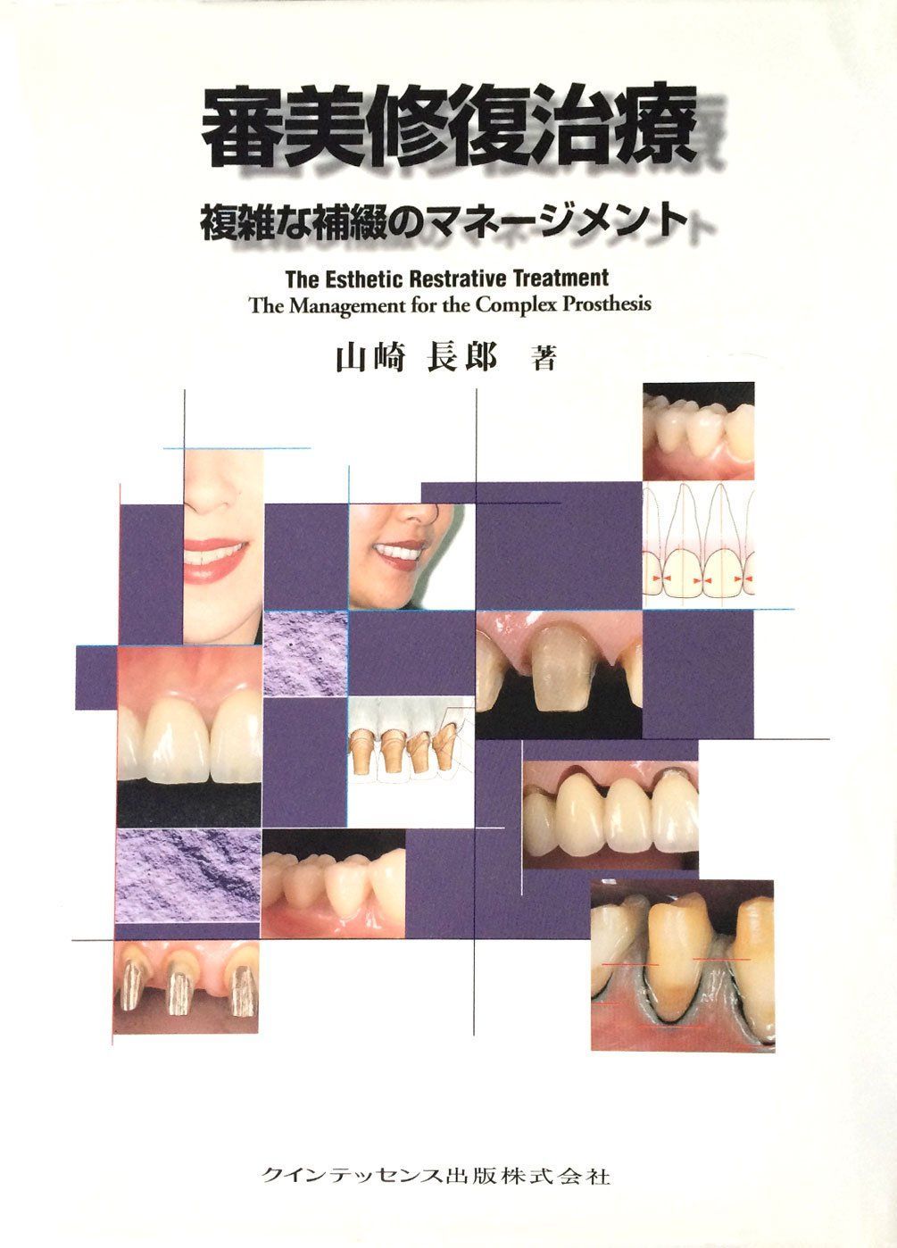 審美修復治療: 複雑な補綴のマネ-ジメント