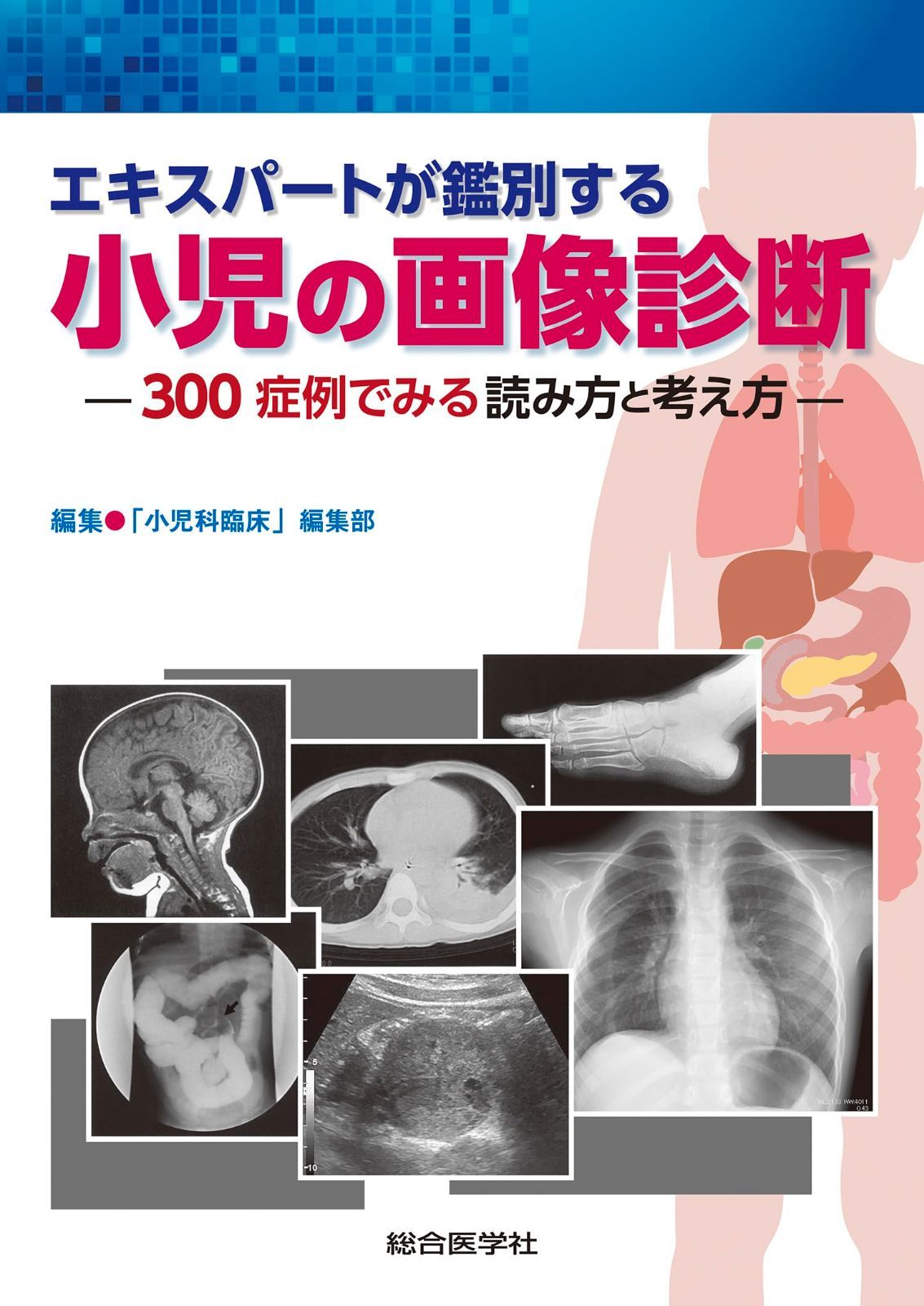 エキスパートが鑑別する 小児の画像診断: 300症例でみる読み方と考え方