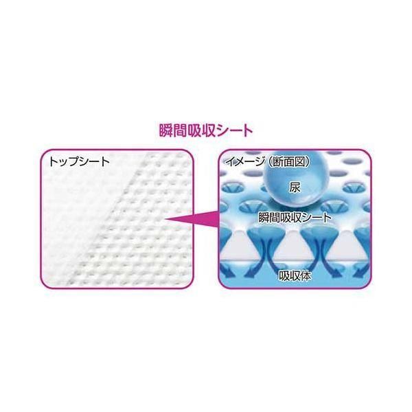ds-リブドゥコーポレーション リフレスピードキャッチウルトラ4P