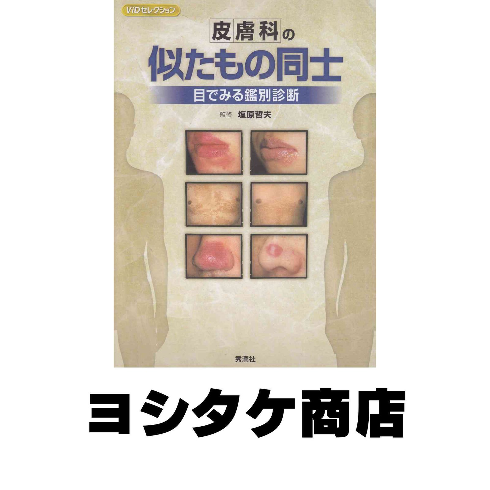 皮膚科の似たもの同士: 目でみる鑑別診断 (ViDセレクション) 塩原哲夫