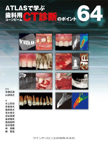 ATLASで学ぶ　歯科用コーンビームCT診断のポイント64