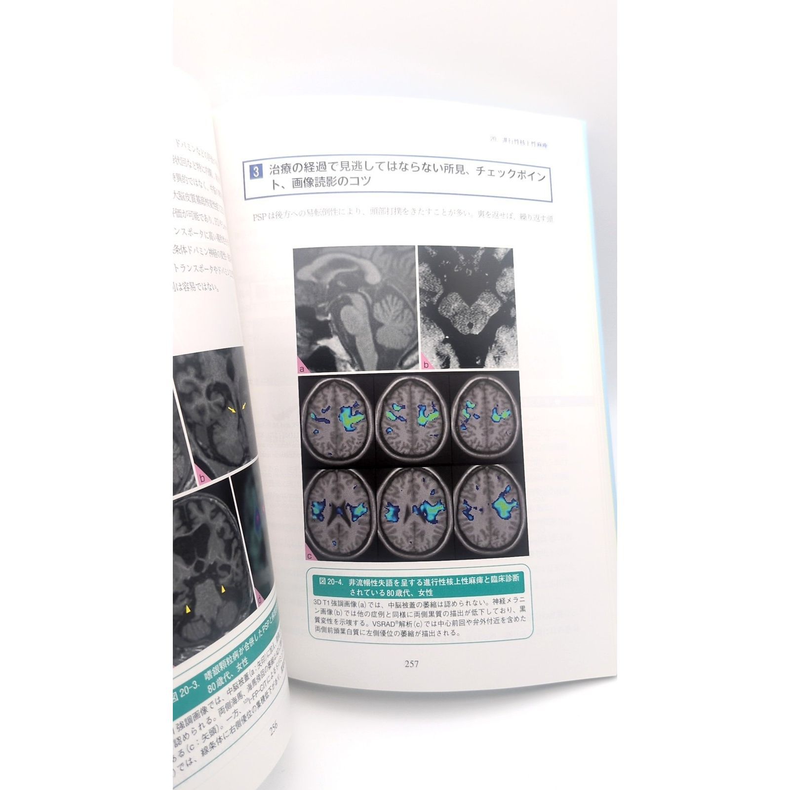 こう読む 認知症 原因診断のための脳画像: 内科系と脳外科の診断流儀