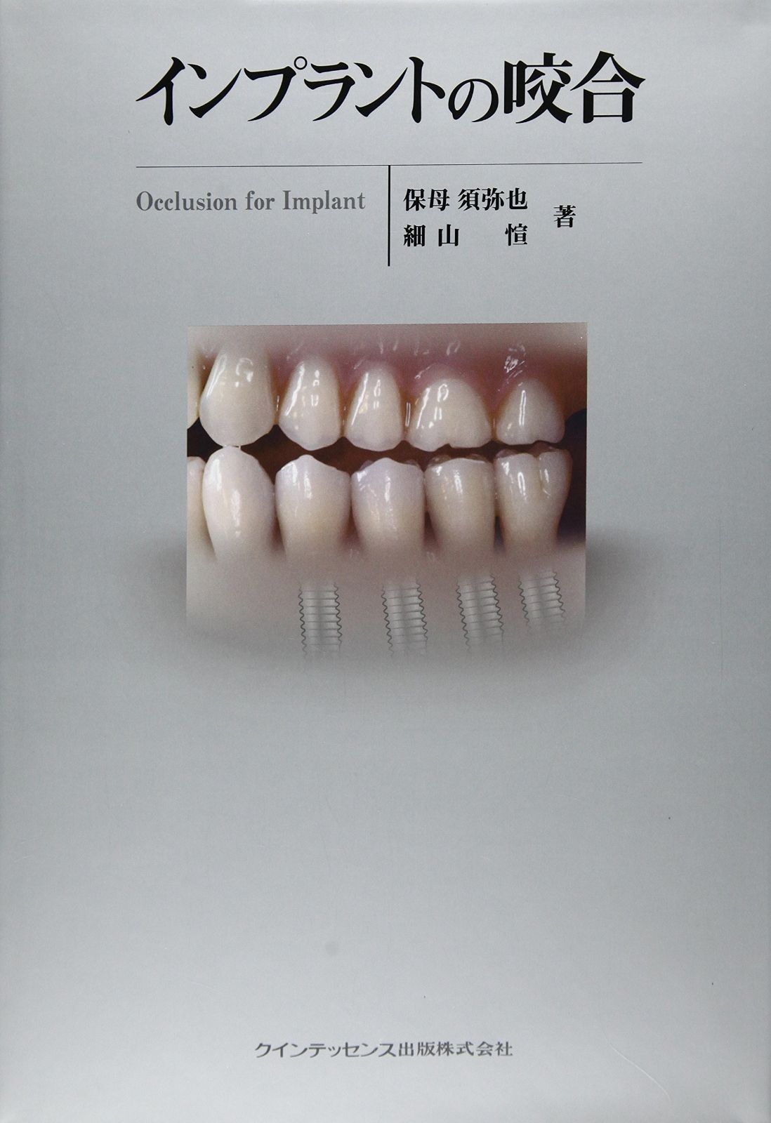 インプラントの咬合