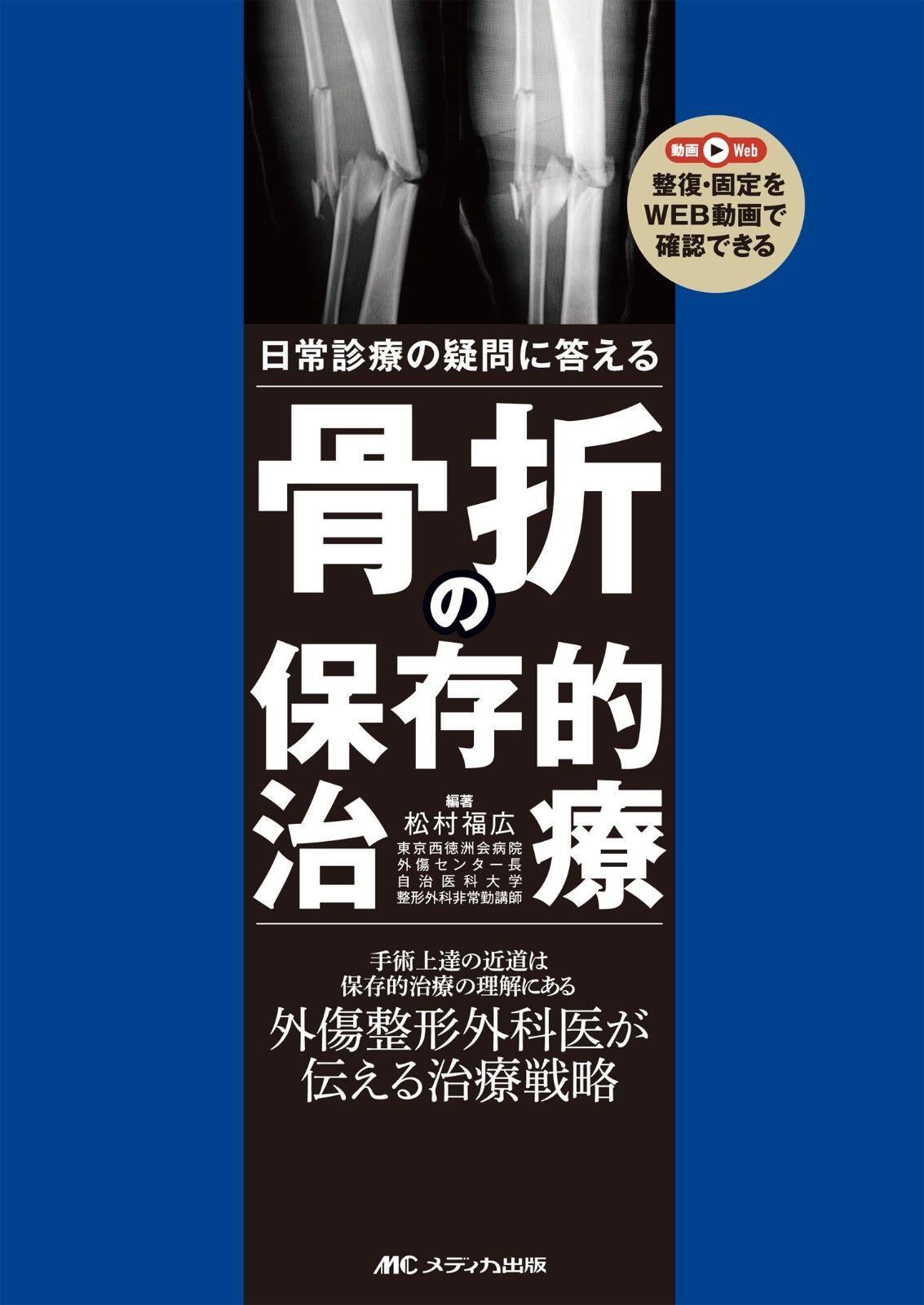 骨折の保存的治療: 日常診療の疑問に答える
