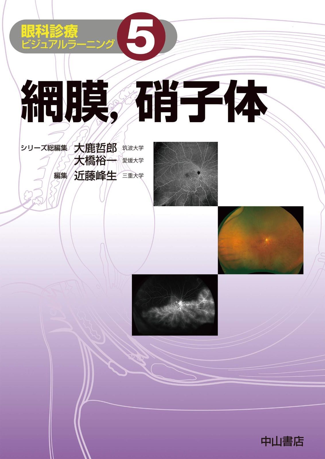 網膜,硝子体 (眼科診療ビジュアルラーニング)