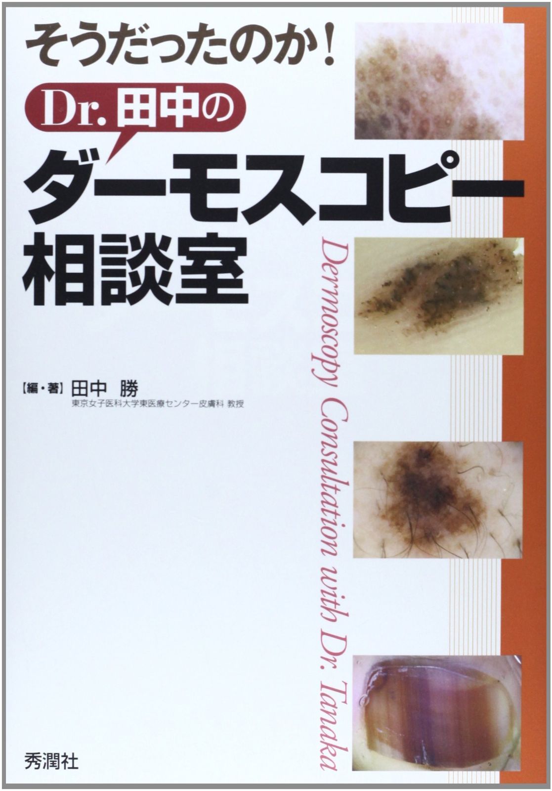 そうだったのか!Dr.田中のダーモスコピー相談室