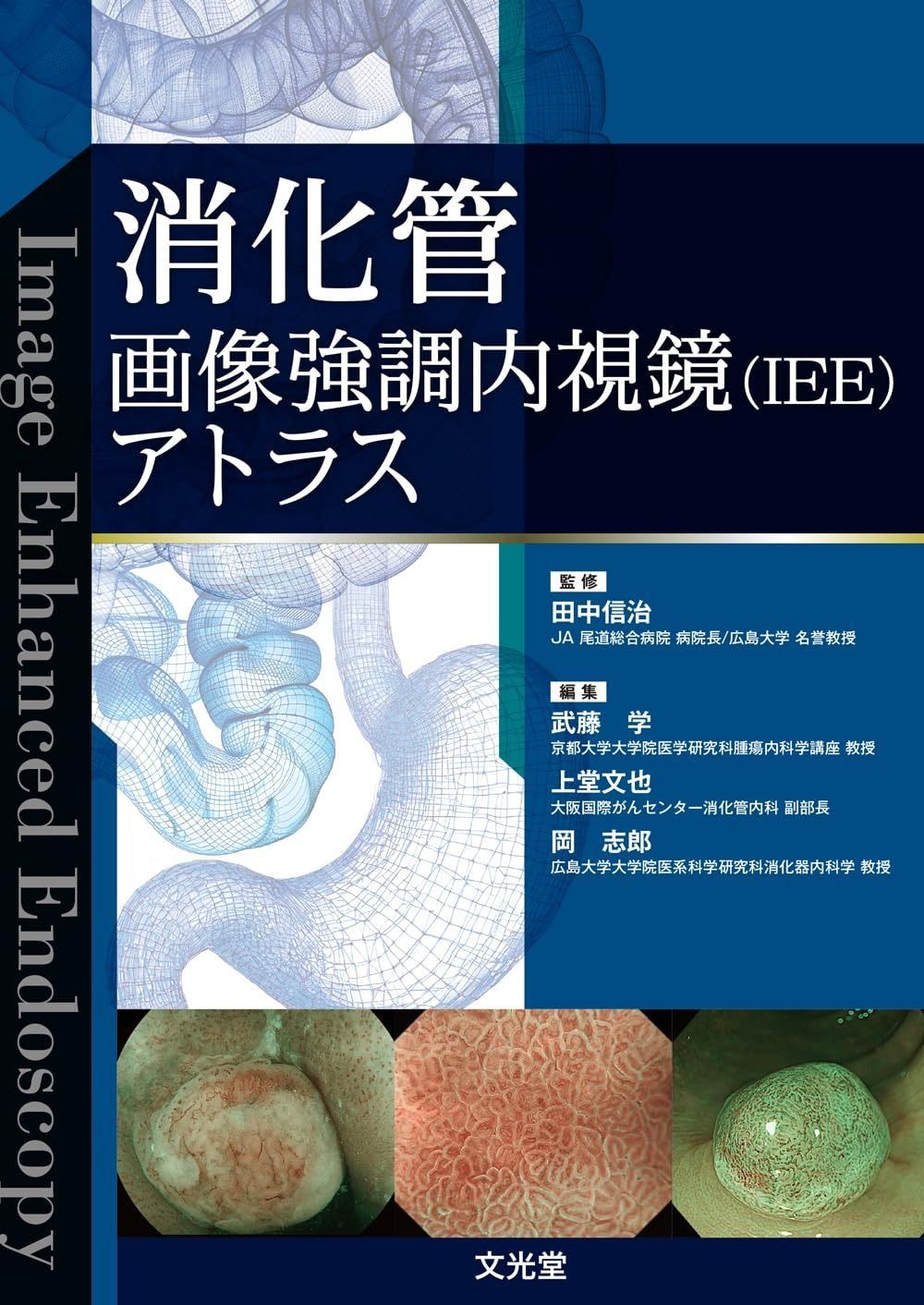 消化管画像強調内視鏡(IEE)アトラス 13,631円
