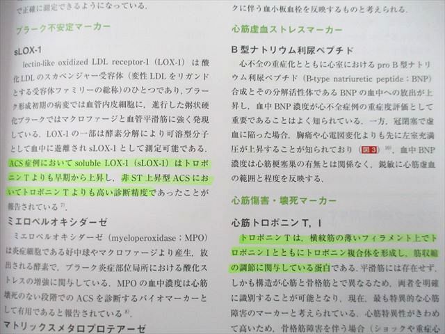 UD25-106 医学出版 月刊 循環器 CIRCULATION ACSの診断と治療 2013年5月号 07m3D