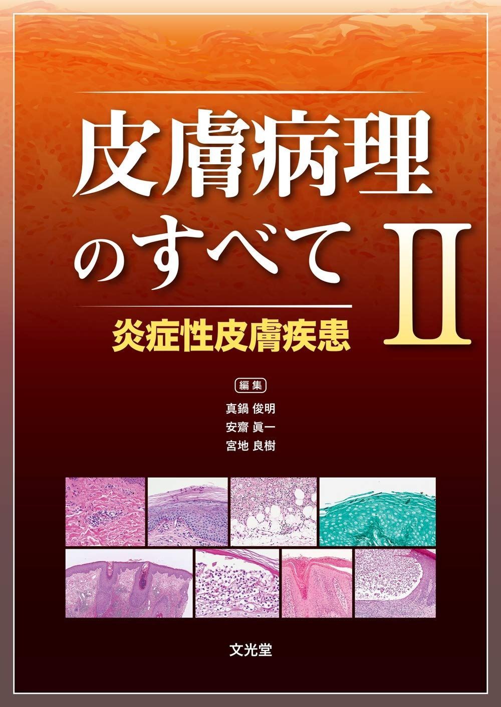 皮膚病理のすべて II 炎症性皮膚疾患