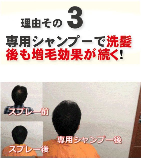 QZジェントルセット 超耐水増毛スプレー