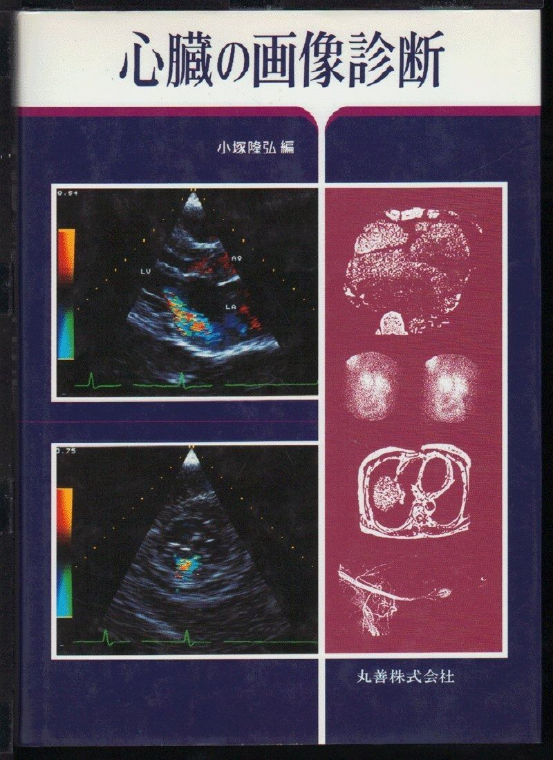 心臓の画像診断 超格安価格