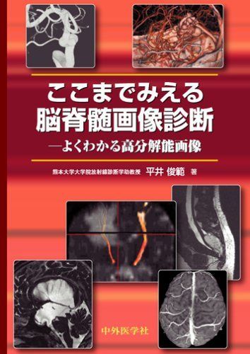 100%新品，大得価 ここまでみえる脳脊髄画像診断-よくわかる高分解能画像 [単行本] 平井俊範 語学・辞書・学習参考書