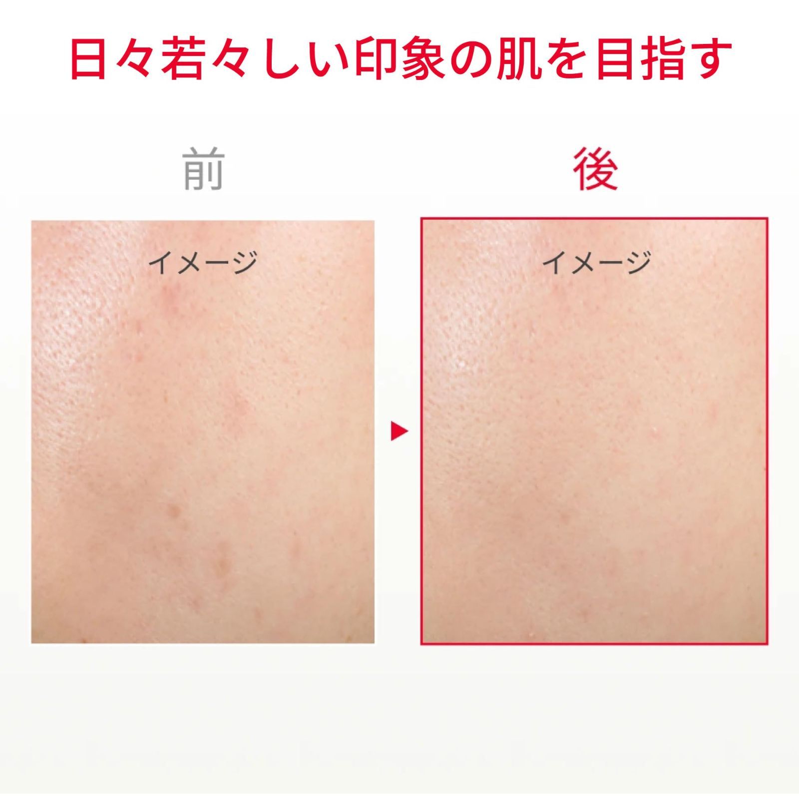 SK-II