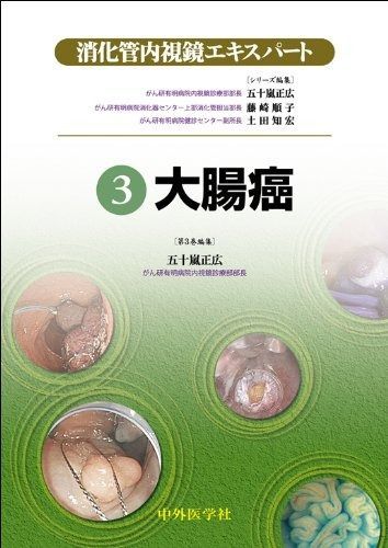 大腸癌 (消化管内視鏡エキスパ-ト) | 大腸がん-内視鏡の治療と検査- メディカルノート 五十嵐 (消化管内視鏡エキスパ-ト) 独立行政法人国立病院